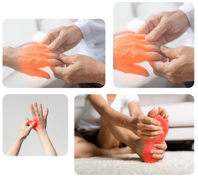 Neuropathy Symptoms